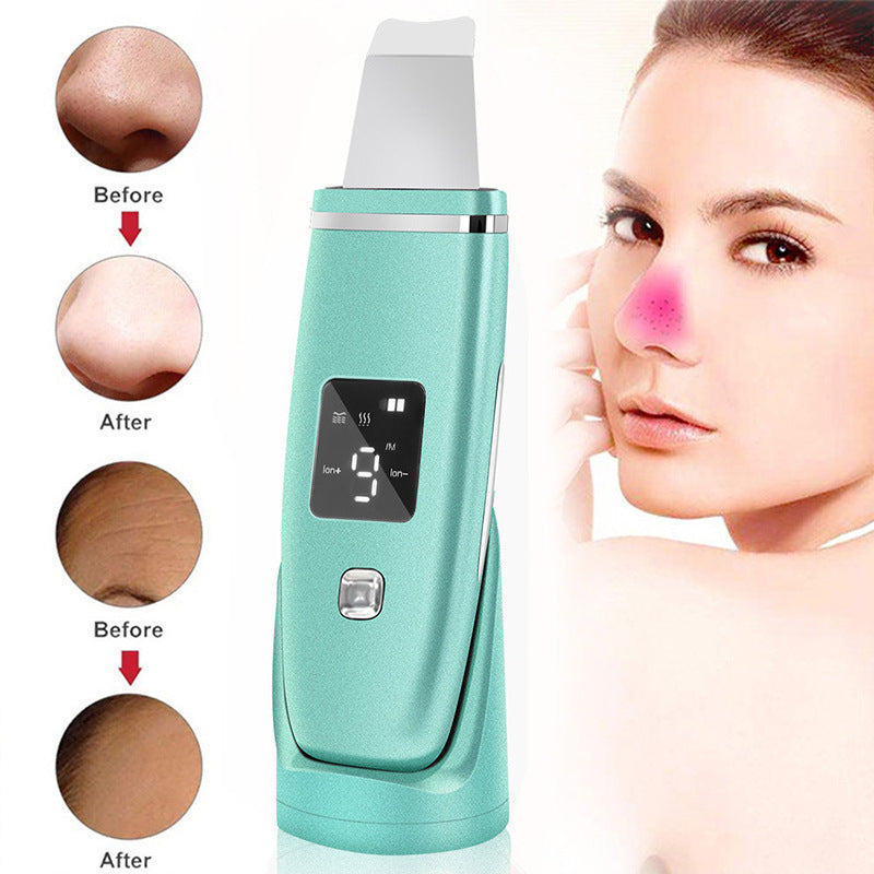 Ultrasonic Vibration Blackhead Remover & Deep Cleansing Face Scrubber